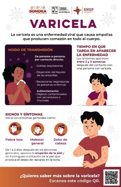 Salud Sonora comparte consejos prácticos para evitar la varicela